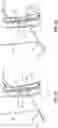 Fig. 14 - Devices and methods using percutaneous transjugular carotid flow reversal