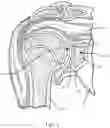 Fig. 02 - Method of using a combination driver/anti-rotation handle for shoulder arthroplasty