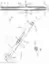 Fig. 06 - Method of using a combination driver/anti-rotation handle for shoulder arthroplasty