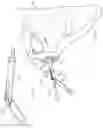 Fig. 10 - Method of using a combination driver/anti-rotation handle for shoulder arthroplasty