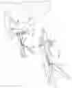Fig. 11 - Method of using a combination driver/anti-rotation handle for shoulder arthroplasty