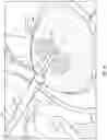 Fig. 09 - METHODS AND DEVICES FOR TREATING STROKE