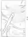 Fig. 11 - METHODS AND DEVICES FOR TREATING STROKE