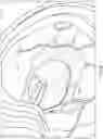 Fig. 19 - METHODS AND DEVICES FOR TREATING STROKE