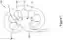 Fig. 02 - PERCUTANEOUS ACCESS DEVICE WITH ADJUSTABLE DEPTH STOP