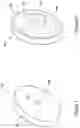 Fig. 09 - PERCUTANEOUS ACCESS DEVICE WITH ADJUSTABLE DEPTH STOP