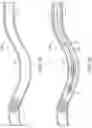 Fig. 02 - Apparatus, system, and method for vasculature obstruction removal