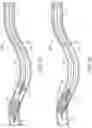 Fig. 03 - Apparatus, system, and method for vasculature obstruction removal