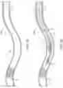 Fig. 06 - Apparatus, system, and method for vasculature obstruction removal