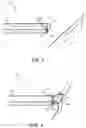 Fig. 02 - Nerve and soft tissue removal device