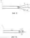 Fig. 06 - Nerve and soft tissue removal device