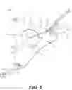 Fig. 04 - Surgical guidance devices, systems, and methods