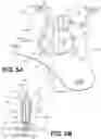 Fig. 06 - Surgical guidance devices, systems, and methods