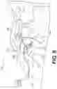 Fig. 10 - Surgical guidance devices, systems, and methods
