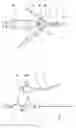 Fig. 07 - MEDICAL DEVICE HAVING VISUAL PUNCTURE APPARATUS