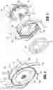 Fig. 04 - SEALS FOR SURGICAL ACCESS DEVICES
