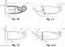 Fig. 33 - Passive safety intraosseous device
