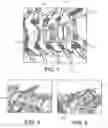 Fig. 08 - Implantable vertebral frame systems and related methods for spinal repair