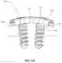 Fig. 14 - Implantable vertebral frame systems and related methods for spinal repair
