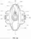 Fig. 17 - Implantable vertebral frame systems and related methods for spinal repair