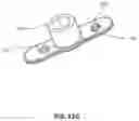 Fig. 22 - Implantable vertebral frame systems and related methods for spinal repair