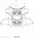 Fig. 47 - Implantable vertebral frame systems and related methods for spinal repair