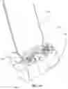 Fig. 50 - Implantable vertebral frame systems and related methods for spinal repair