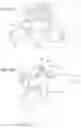 Fig. 03 - Device and method for reinforcement of a facet
