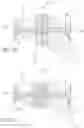 Fig. 23 - Device and method for reinforcement of a facet