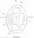 Fig. 28 - Device and method for reinforcement of a facet