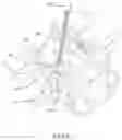 Fig. 32 - Device and method for reinforcement of a facet