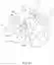 Fig. 33 - Device and method for reinforcement of a facet