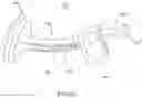 Fig. 44 - Device and method for reinforcement of a facet