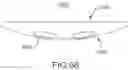 Fig. 48 - Device and method for reinforcement of a facet