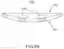 Fig. 49 - Device and method for reinforcement of a facet