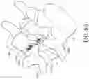 Fig. 66 - Device and method for reinforcement of a facet