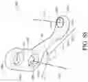 Fig. 68 - Device and method for reinforcement of a facet