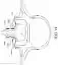 Fig. 71 - Device and method for reinforcement of a facet