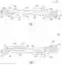 Fig. 02 - Clavicle implants