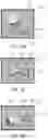 Fig. 12 - Articulating tool for endoscopic placement of fasteners