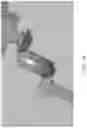 Fig. 22 - Articulating tool for endoscopic placement of fasteners