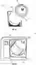 Fig. 07 - Filter connection for a smoke evacuation device
