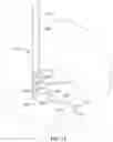 Fig. 22 - DENERVATION METHODS