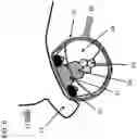 Fig. 07 - APPARATUS, SYSTEMS, AND METHODS FOR OPTIMIZING DELIVERY OF RADIATION TO TREAT CARDIAC ARRHYTHMIAS
