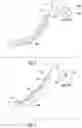 Fig. 05 - DEVICES, SYSTEMS AND METHODS FOR ACCESSING A BODY LUMEN