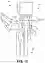 Fig. 17 - Robotically assisted surgical system and related devices and methods