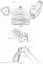 Fig. 02 - Detecting uncontrolled movement