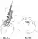 Fig. 02 - Medical device anchoring
