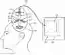 Fig. 01 - SYSTEM FOR ENDOSCOPIC INTRACRANIAL PROCEDURES