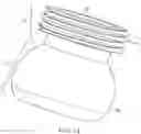 Fig. 14 - SYSTEM FOR ENDOSCOPIC INTRACRANIAL PROCEDURES